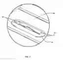 Fig. 08 - BLADE ENCLOSURE FOR A TABLE SAW
