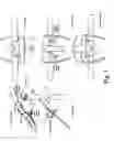 Fig. 02 - Eyeglasses retainer for handle bars