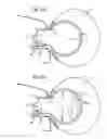 Fig. 03 - Airbag system