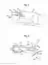Fig. 05 - Airbag system