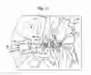 Fig. 09 - Airbag system