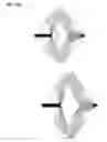 Fig. 45 - Reflective axicon systems and methods