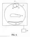 Fig. 07 - COMPUTER TOMOGRAPHY APPARATUS