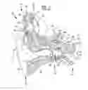 Fig. 02 - Cancellation of bone-conducted sound in a hearing prosthesis