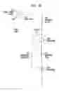 Fig. 05 - Cancellation of bone-conducted sound in a hearing prosthesis