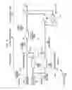 Fig. 07 - Cancellation of bone-conducted sound in a hearing prosthesis
