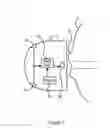 Fig. 02 - Noise cancellation system with lower rate emulation