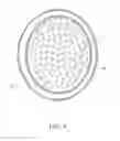 Fig. 08 - Single Chamber headphone apparatus