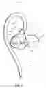 Fig. 02 - IN-EAR HEADPHONES