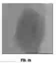 Fig. 07 - Method of compensation of respiratory motion in cardiac imaging
