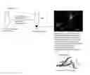 Fig. 01 - BINDING OF PATHOLOGICAL FORMS OF PROTEINS USING CONJUGATED POLYELECTROLYTES