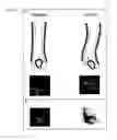 Fig. 02 - SELECTING/IDENTIFYING AND ADMINISTERING ACTIVE AGENTS USEFUL FOR MODIFYING THE SHAPE OF KERATIN/HAIR FIBERS