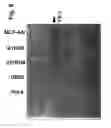 Fig. 07 - Methods for Reversing Multiple Resistance in Animal Cells