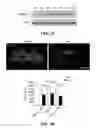 Fig. 12 - Ninjurin-1 modulation and uses thereof