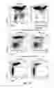 Fig. 22 - Ninjurin-1 modulation and uses thereof