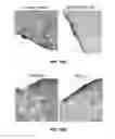 Fig. 23 - Ninjurin-1 modulation and uses thereof