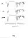 Fig. 02 - Crystal modification A of 1-(2,6-difluorobenzyI)-1 H-1,2,3-triazole-4-carboxamide and dosage forms and formulations thereof