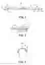 Fig. 02 - Implantable Medical Device Having a Conformal Coating and Method for Manufacture