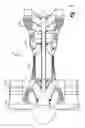 Fig. 02 - Plastic welding using fiber reinforcement materials
