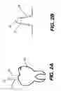 Fig. 03 - Apparatus for dental surface shape and shade imaging