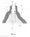 Fig. 08 - Device for centering and guiding a drill bit of a dental handpiece