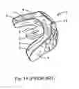 Fig. 02 - ORAL TONGUE POSITIONING DEVICE