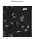Fig. 01 - Multiplex cell signalling assays