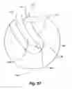 Fig. 33 - Exercise machine having rotatable weight selection index