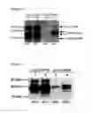 Fig. 06 - Splice variants of GDNF and uses thereof