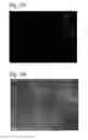 Fig. 09 - Nanoparticles comprising calcium phosphate and ethylene imine compositions and methods of production thereof