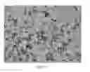 Fig. 02 - Process for optimizing the particle size of an active pharmaceutical ingredient by crystallization