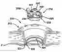 Fig. 01 - Methods and devices for accessing a body cavity using a surgical access device with modular seal components
