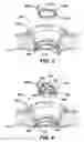 Fig. 03 - Methods and devices for accessing a body cavity using a surgical access device with modular seal components