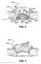 Fig. 04 - Methods and devices for accessing a body cavity using a surgical access device with modular seal components