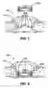 Fig. 05 - Methods and devices for accessing a body cavity using a surgical access device with modular seal components