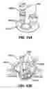 Fig. 16 - Methods and devices for accessing a body cavity using a surgical access device with modular seal components