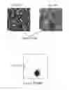 Fig. 16 - METHOD AND SYSTEM FOR DETECTING AND GRADING PROSTATE CANCER