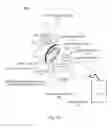Fig. 29 - METHOD AND SYSTEM FOR DETECTING AND GRADING PROSTATE CANCER