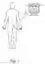 Fig. 02 - Systems and methods for lumbar cerebrospinal fluid access and treatment