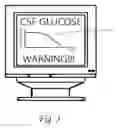 Fig. 04 - Systems and methods for lumbar cerebrospinal fluid access and treatment
