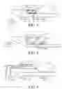 Fig. 03 - Systems and methods for detecting labor conditions via electromagnetic field disturbances