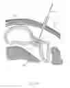 Fig. 33 - Obesity Treatment Systems