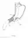 Fig. 41 - Obesity Treatment Systems