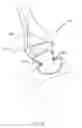 Fig. 46 - Obesity Treatment Systems