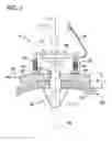 Fig. 02 - Gastrostomy feeding apparatus and method