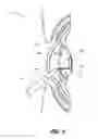 Fig. 10 - Capsulotomy repair device and method for capsulotomy repair