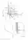 Fig. 02 - Surgical drill guide with awl and method of use