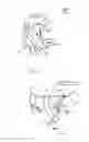 Fig. 06 - Surgical drill guide with awl and method of use