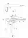 Fig. 06 - INTERRUPTED TISSUE APPOSITION DEVICES