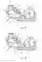 Fig. 07 - Tourniquet